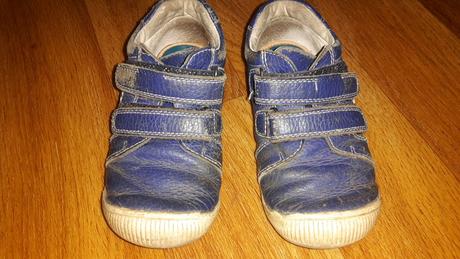 Topánky protetika, protetika,25