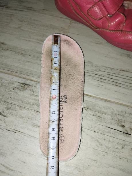 Protetika zimne, protetika,29