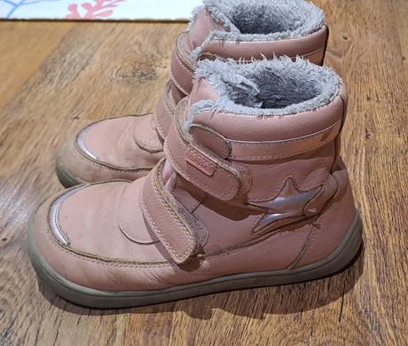 Zimne topanky, protetika,31