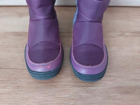 Protetika čižmy, protetika,34