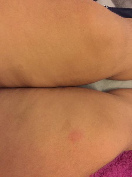 Môže to byť zrazenina?