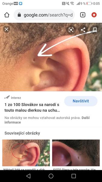 Mám dierku pri uchu