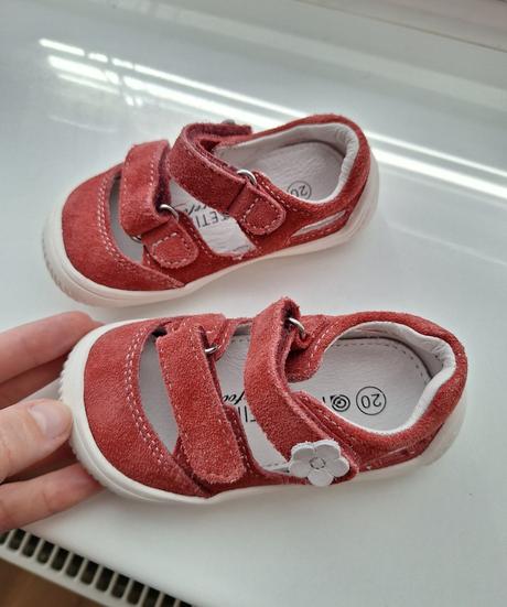 Sandálky protetika, protetika,20