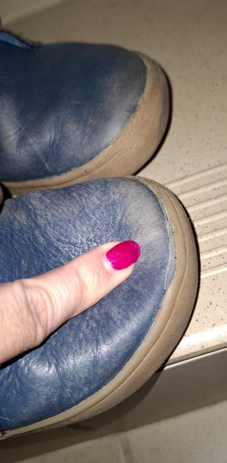 Topánky zimné, protetika,31