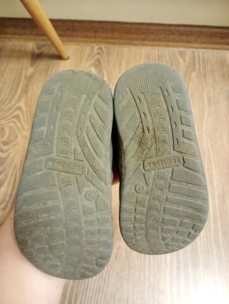 Prechodné topánky protetika barefoot, protetika,23