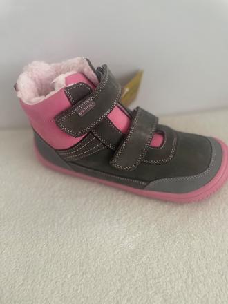 Bf protetika, protetika,35