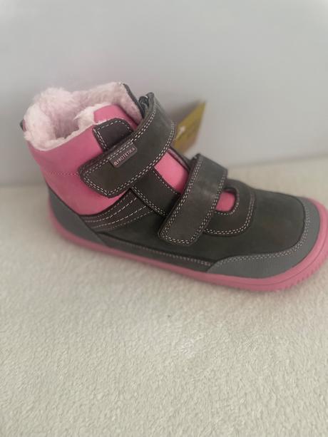 Bf protetika, protetika,35