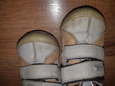 Prechodné topánky, protetika,21
