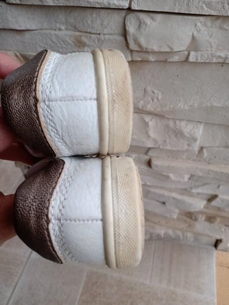 Topanky protetika s postovnym, protetika,22