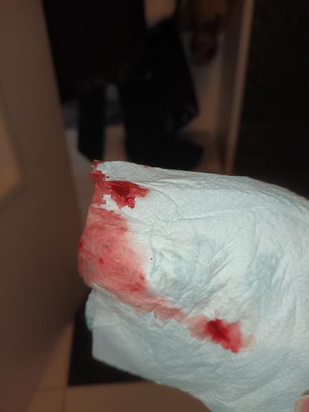 Je normálne mať kŕče v 2. - 3. týždni tehotenstva?