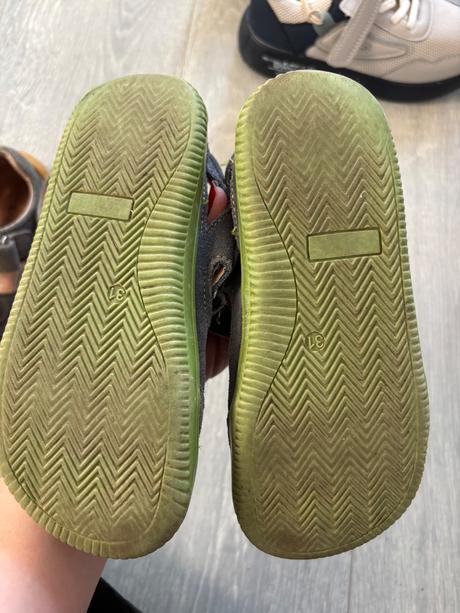 Sandálky protetika, protetika,31