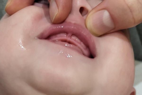 Môžu byť štvormesačnému dieťaťu problémy so zúbkami?