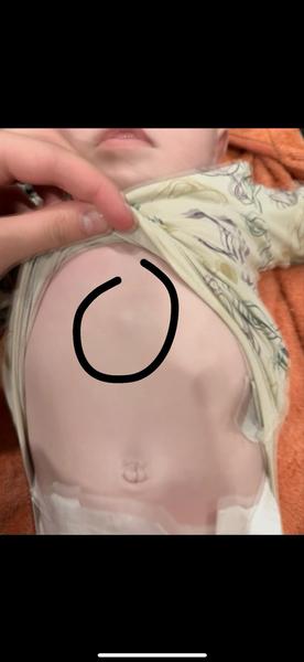 Hrčka nad bruškom bábätka