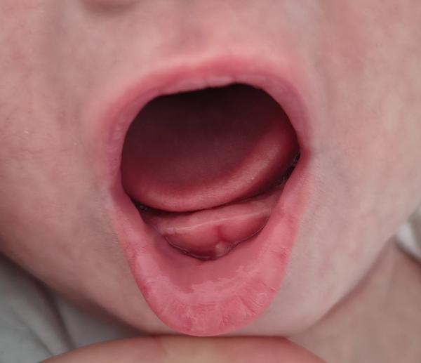 Sú to zúbky u trojmesačného bábätka?