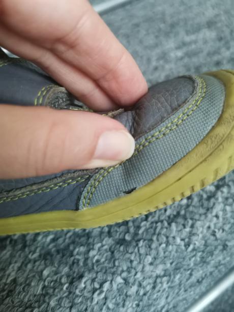 Protetika tyrel 32, protetika,32