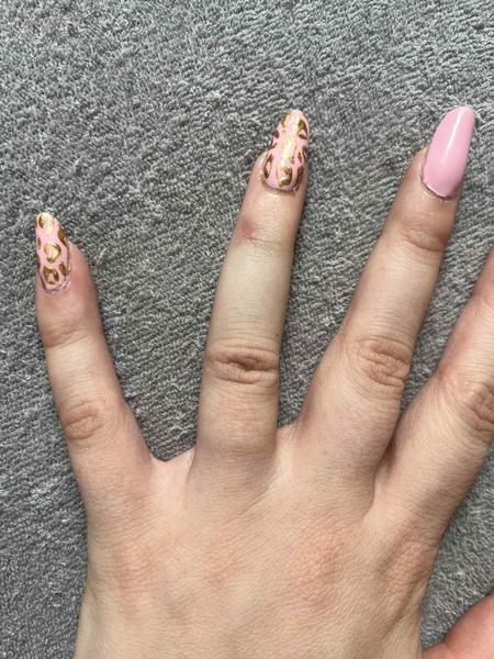 Je to zlomený alebo len narazený prst?