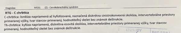 Mám lordózu a naznačenú skoliózu. Budú mi stačiť len rehabilitácie?