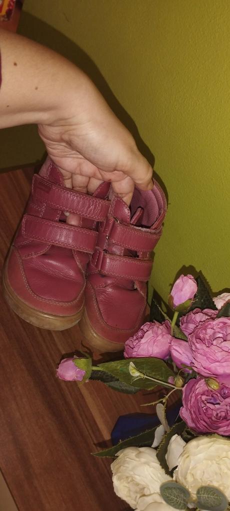Prechodné barefoot topánky protetika, protetika,27