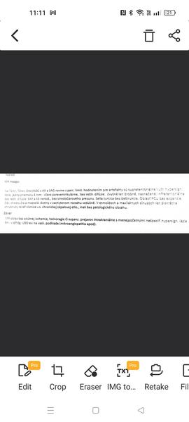 Kedy môžem očakávať výsledky z MRI mozgu?