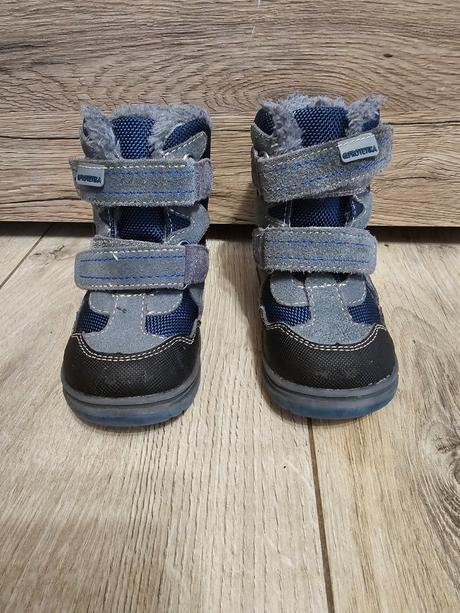 Zimne cizmicky protetika, protetika,20