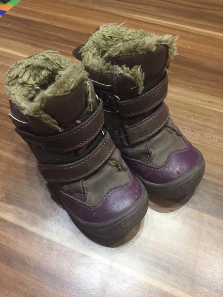 Protetika cizmicky, protetika,22