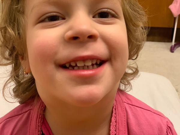 Je zdurenie uzlín u 3-ročnej dcéry normálne?