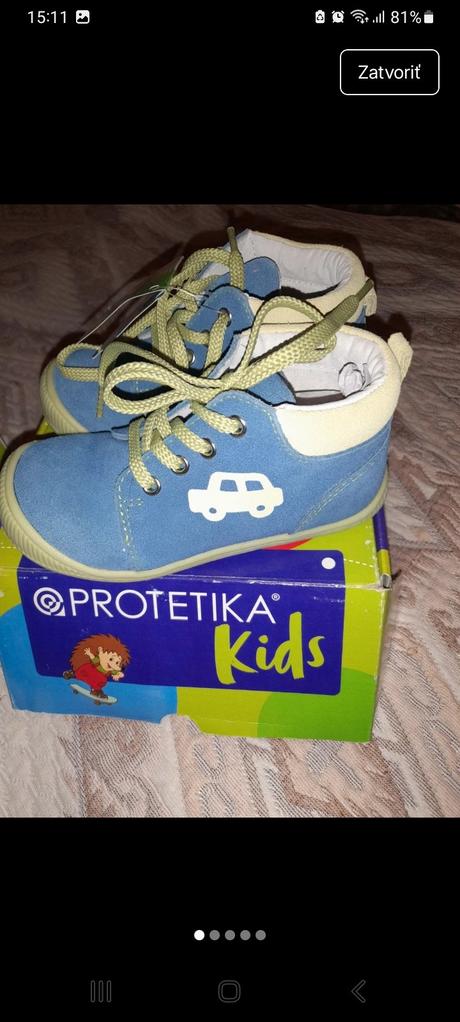 Nove protetika topánky, protetika,24