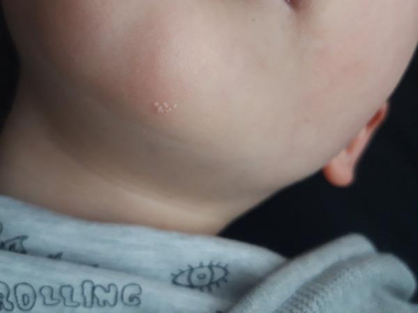 Čo to má syn na brade?