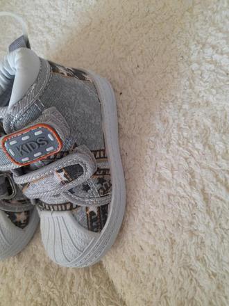 Nové papuče protetika, protetika,20 / 21