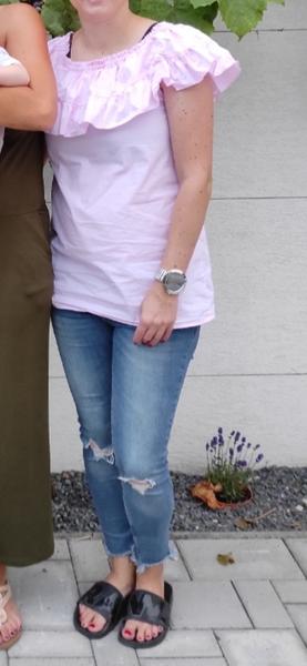 Koža plná znamienok a nulové sebavedomie. Som v tom sama?