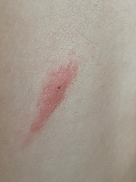 Čo spôsobilo červený fľak?