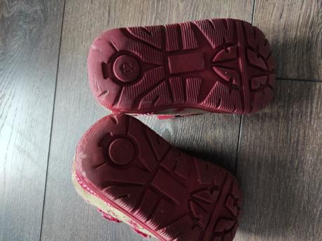 Topánky protetika 20, protetika,20