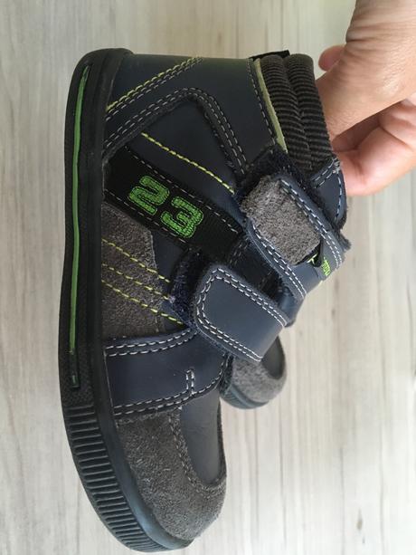 Topanocky protetika, protetika,23