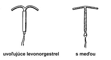Vnútromaternicové teliesko Vnútromaternicové teliesko