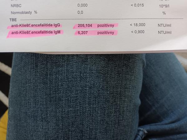 Nemôže prísť po prekonaní kliešťovej encefalitídy druhá fáza tejto choroby?