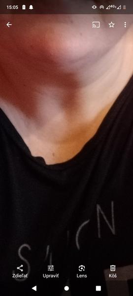 Prečo sa objavuje jamka v strede hrdla?