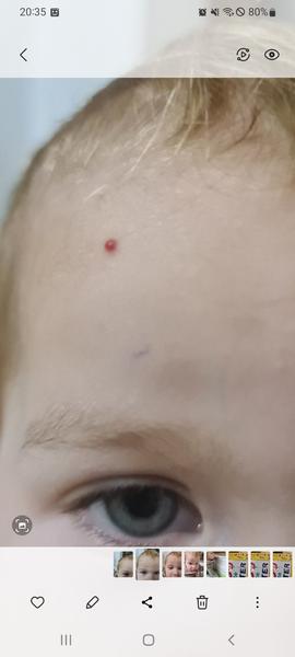 Čo môže byť toto červené znamienko?