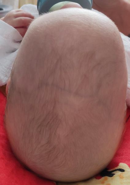 Je takýto tvar hlavy vhodný na operáciu?