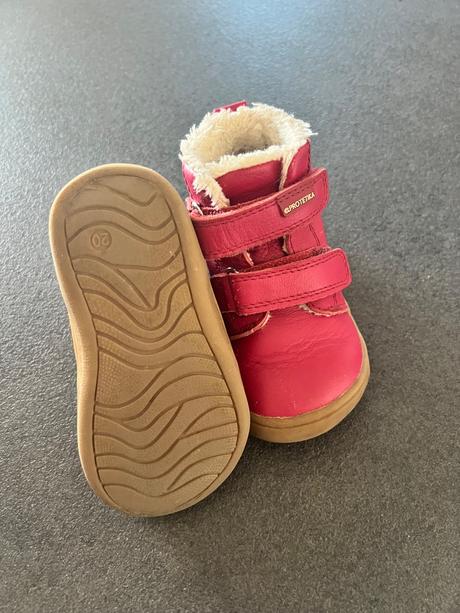 Kozene protetika topanky v.20, protetika,20