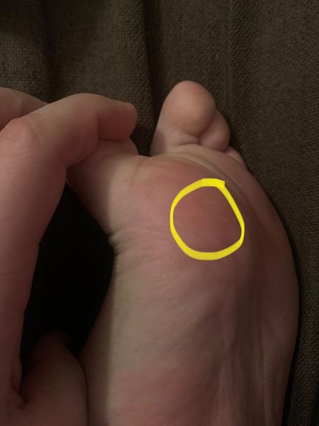 Mierna bolesť na chodidle