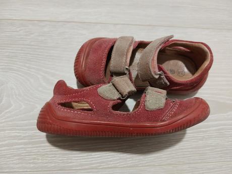 Sandalky protetika, protetika,24