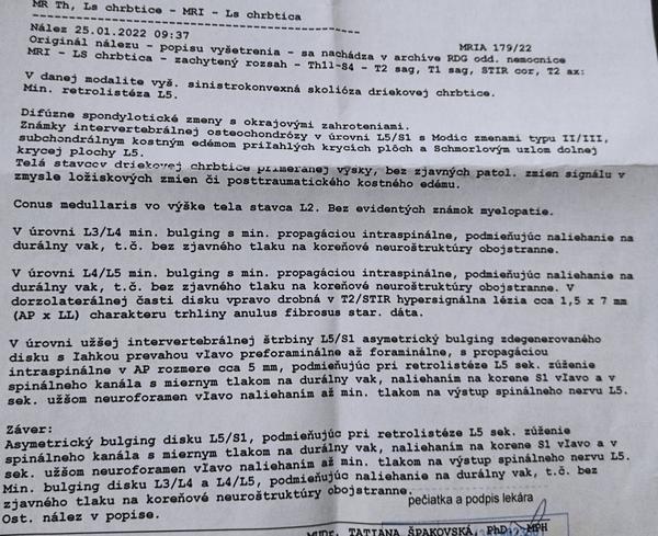 Aké sú moje výsledky z MR chrbtice?