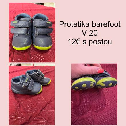 Chlapcenske topanky, protetika,20