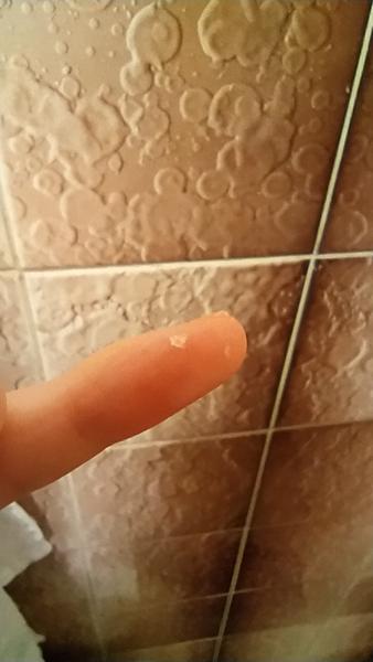 Čo znamenajú biele šupinky v ušiach?