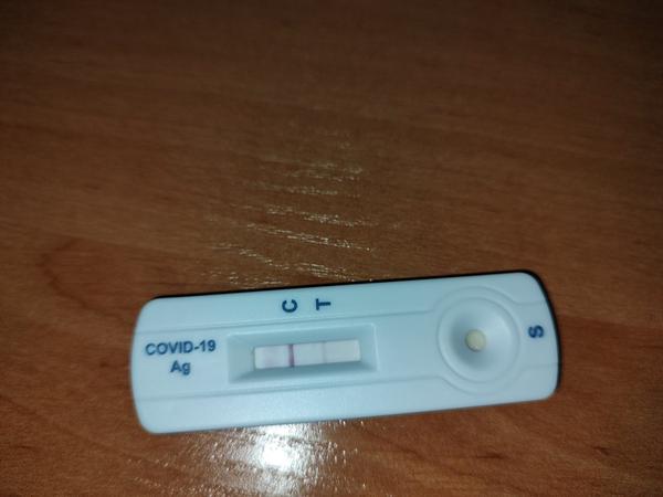 Je to pozitívny AG test?