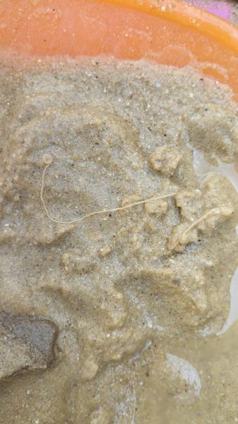 Mohol byť v detskom piesku parazit?