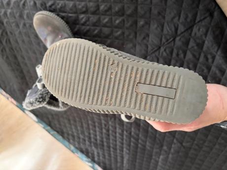 Zimne teplucke protetika topanky, protetika,31