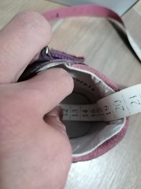 Krasne poltopanocky protetika, protetika,22