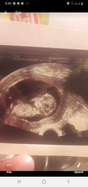 Je to podľa vás chlapček alebo dievčatko ?