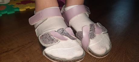 Sandalky ortopedicke, 33